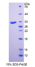 结构特异性识别蛋白1(SSRP1)重组蛋白