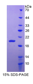 肝细胞核因子1β(HNF1β)重组蛋白