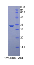 肝配蛋白A受体1(EPHA1)重组蛋白