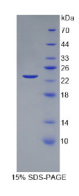 血管内皮生长因子145(VEGF145)重组蛋白