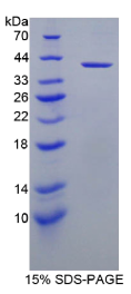 胰岛素样生长因子1(IGF1)重组蛋白