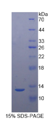 尾加压素2(UST2)重组蛋白