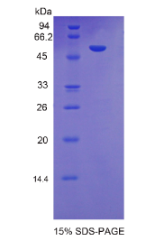 激肽释放酶7(KLK7)重组蛋白