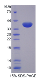 分泌型卷曲相关蛋白1(SFRP1)重组蛋白