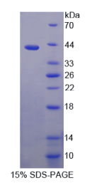 矢车菊苷α2(CENTα2)重组蛋白