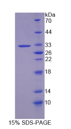 胱天蛋白酶14(CASP14)重组蛋白