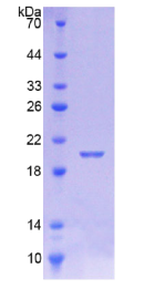 钙调蛋白样蛋白5(CALML5)重组蛋白