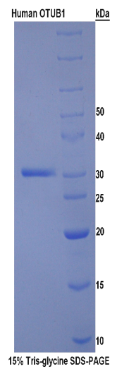 卵巢肿瘤蛋白1(OTUB1)重组蛋白
