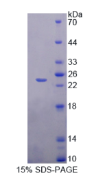 含Mab21域蛋白1(MB21D1)重组蛋白