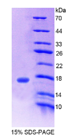 烟碱型胆碱受体β3(CHRNβ3)重组蛋白