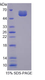 硬骨素(SOST)重组蛋白