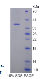 调素(RGN)重组蛋白