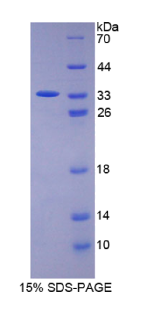 信号转导衔接分子1(STAM1)重组蛋白