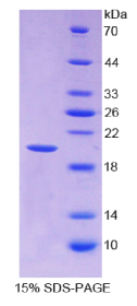 膜联蛋白A4(ANXA4)重组蛋白