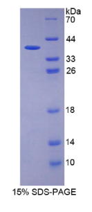 角蛋白13(KRT13)重组蛋白