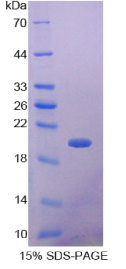 生长分化因子9(GDF9)重组蛋白