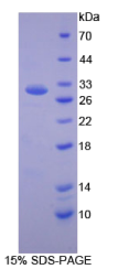 激肽释放酶5(KLK5)重组蛋白
