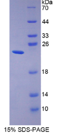 胃动蛋白2(GKN2)重组蛋白