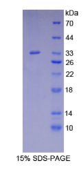 含Src同源物2域适配蛋白B(SHB)重组蛋白