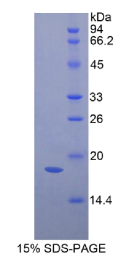 胃动蛋白1(GKN1)重组蛋白