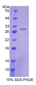 晶状体蛋白βA1(CRYβA1)重组蛋白