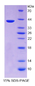 角蛋白3(KRT3)重组蛋白