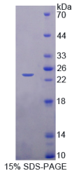 无刚毛鳞甲复合体样蛋白1(ASCL1)重组蛋白