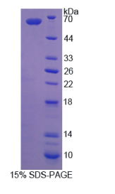 可溶性半乳糖凝集素3结合蛋白(LGALS3BP)重组蛋白