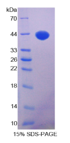 胰岛素样生长因子1(IGF1)重组蛋白