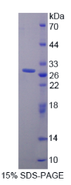 基质相互作用分子1(STIM1)重组蛋白