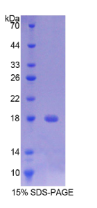 跨膜蛋白27(TMEM27)重组蛋白