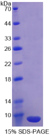 血小板反应蛋白解整合素金属肽酶8(ADAMTS8)重组蛋白