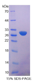 钙非依赖性磷脂酶A2(iPLA2)重组蛋白