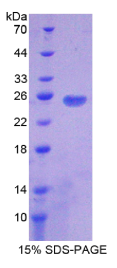 细胞程序性死亡蛋白1配体2(PDCD1LG2)重组蛋白