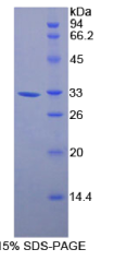 膜联蛋白A6(ANXA6)重组蛋白