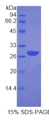 生长因子受体结合蛋白2(Grb2)重组蛋白