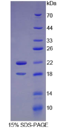 集落刺激因子2受体α(CSF2Rα)重组蛋白