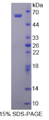 醛脱氢酶1家族成员A1(ALDH1A1)重组蛋白