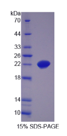 含SCAN域蛋白3(SCAND3)重组蛋白