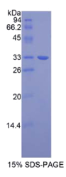 微管蛋白β1(TUBβ1)重组蛋白