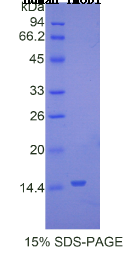 原肌球调节蛋白1(TMOD1)重组蛋白