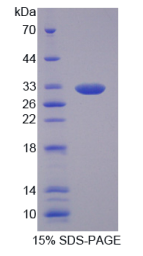 黑素瘤缺乏因子1(AIM1)重组蛋白