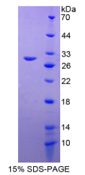 胰岛素样生长因子结合蛋白4(IGFBP4)重组蛋白