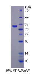 糖蛋白A33(GPA33)重组蛋白