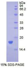 抑丝蛋白1(PFN1)重组蛋白