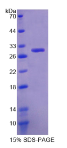 谷胱甘肽S转移酶θ1(GSTθ1)重组蛋白