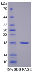 前折叠蛋白亚基1(PFDN1)重组蛋白