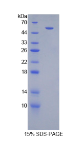 干扰素γ受体1(IFNγR1)重组蛋白