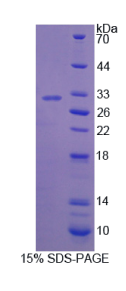 干扰素γ诱导蛋白30(IFI30)重组蛋白