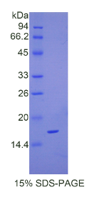 复合素2(CPLX2)重组蛋白